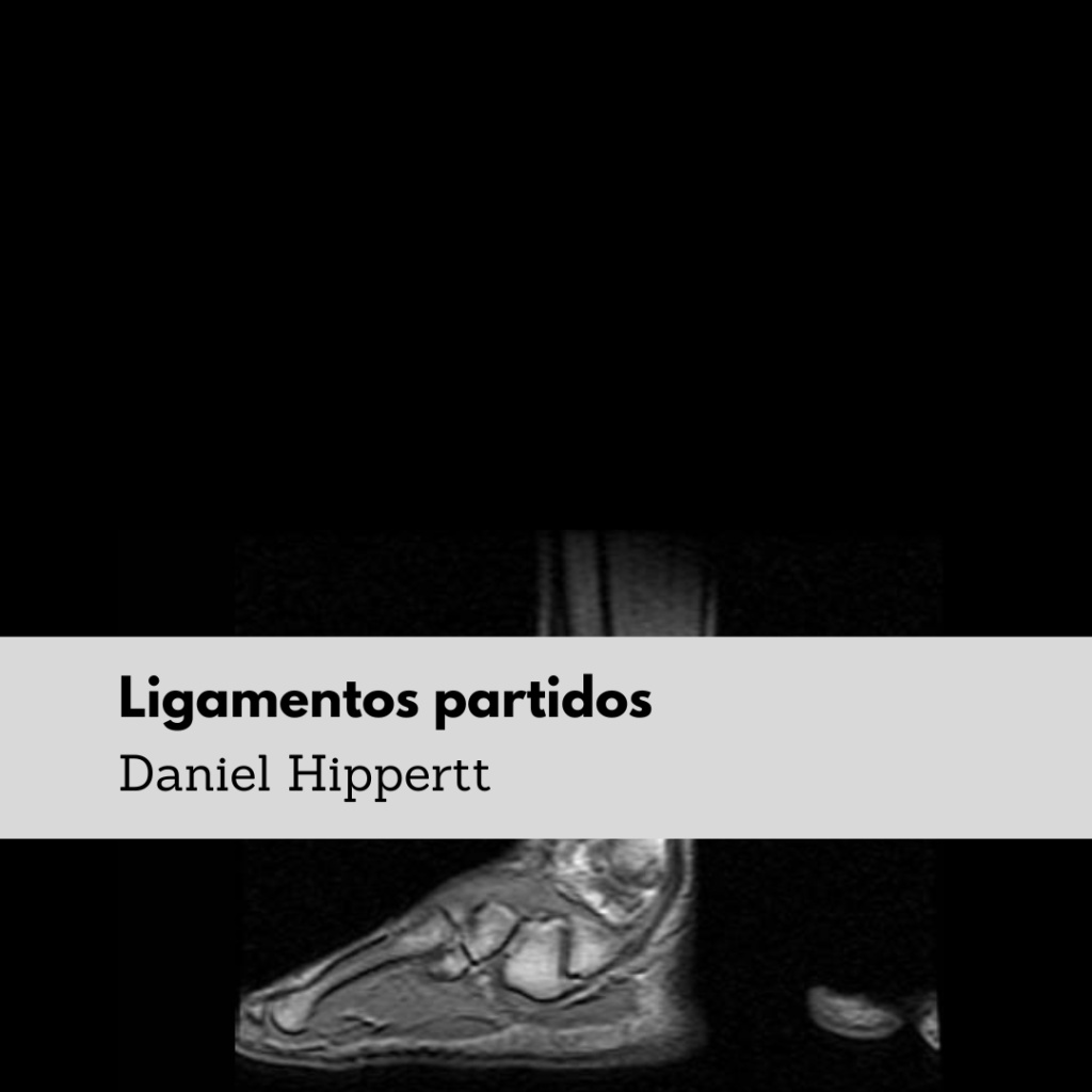 Ligamentos partidos